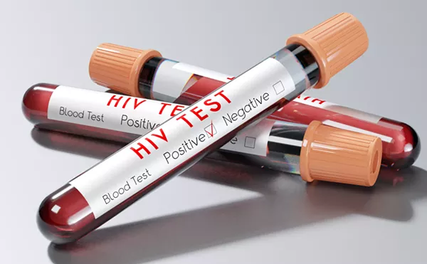 Image: 'A Wake Up Call': HIV and STIs Cost Dallas County Nearly $400 Million