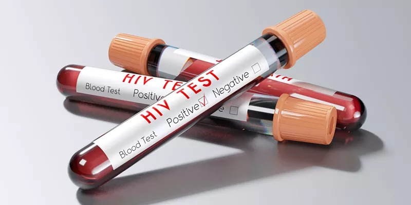 Image: HIV tests