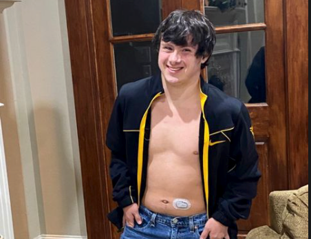 Trevor Gray of Plano decided to finally get a Dexcom patch to help monitor his Type-1 diabetes when he learned his favorite singer Nick Jonas wears one. Jonas rewarded him with a story feature on Instagram.